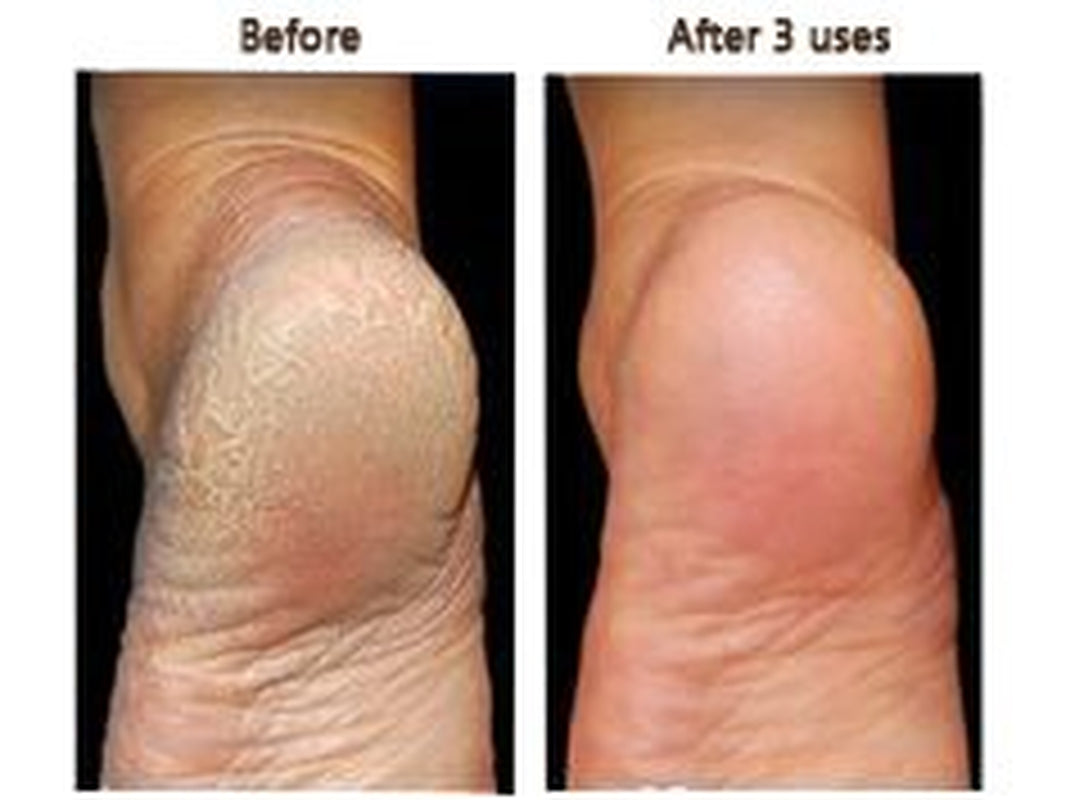 Secrets of the Islands - Cucumber - Cantaloupe Salt Scrub 16 Oz